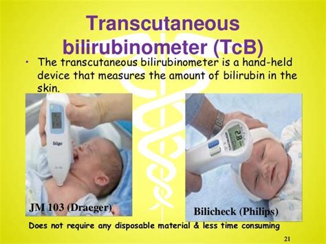 what is tcb in newborn